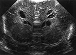 Fig. 8.9 (a)