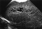 Fig. 8.9 (b)