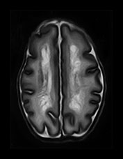 Fig. 8.9 (c)