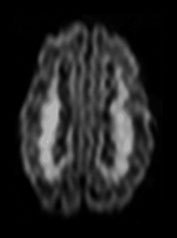 Fig. 8.9 (d)