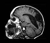 Fig. 8.10 (b)