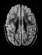 Fig. 8.11 (a)