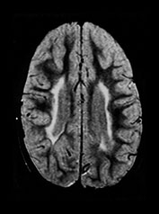 Fig. 8.11 (c)