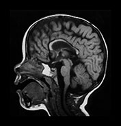 Fig. 8.11 (d)