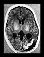 Fig. 8.13 (a)