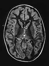 Fig. 8.13 (b)