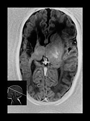 Fig. 8.14