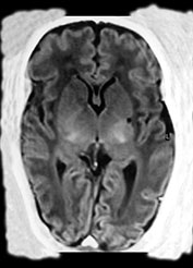 Fig. 8.15 (c)