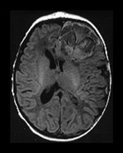Fig. 9.1 (ai)