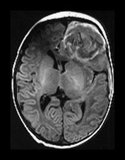 Fig. 9.1 (bi)