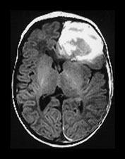 Fig. 9.1 (ci)