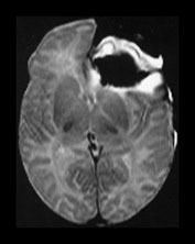 Fig. 9.1 (cii)