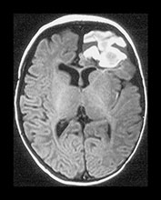 Fig. 9.1 (di)
