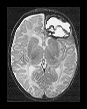 Fig. 9.1 (dii)