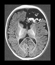 Fig. 9.1 (ei)