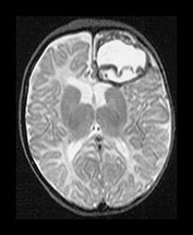 Fig. 9.1 (eii)