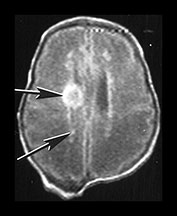 Fig. 9.2 (a)