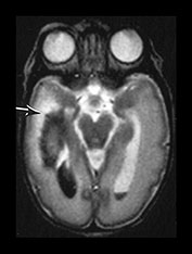 Fig. 9.2 (bii)