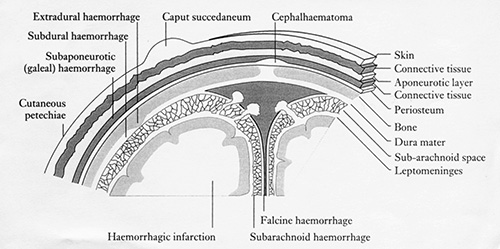 Fig. 9.5