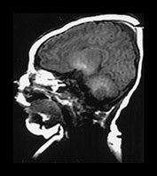 Fig. 9.6 (a)
