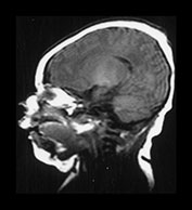 Fig. 9.6 (b)