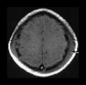 Fig. 9.7 (a)