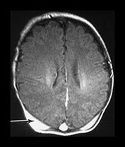 Fig. 9.8 (a)