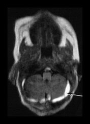 Fig. 9.9 (a)
