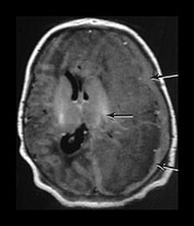 Fig. 9.10 (ai)