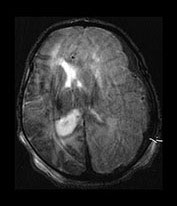 Fig. 9.10 (aii)
