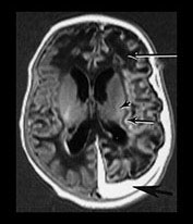 Fig. 9.10 (bi)