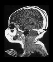 Fig. 9.10 (bii)