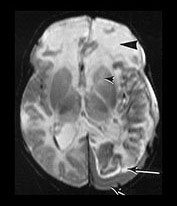 Fig. 9.10 (biii)