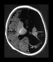 Fig. 9.10 (ci)