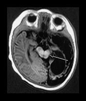 Fig. 9.10 (cii)