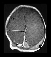 Fig. 9.11 (ai)