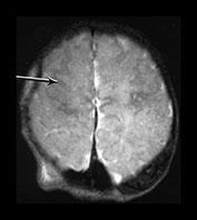 Fig. 9.11 (aii)