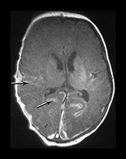 Fig. 9.11 (bi)