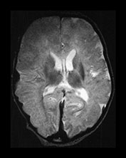 Fig. 9.11 (bii)