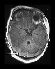 Fig. 9.11 (ci)