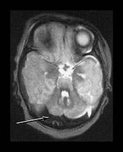Fig. 9.11 (cii)