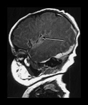 Fig. 9.11 (di)