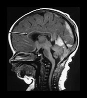 Fig. 9.11 (dii)