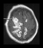Fig. 9.13 (ai)
