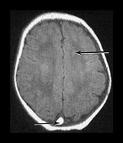 Fig. 9.13 (aii)