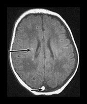 Fig. 9.13 (aiii)