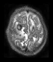 Fig. 9.13 (bi)