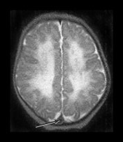 Fig. 9.13 (bii)