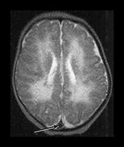 Fig. 9.13 (biii)