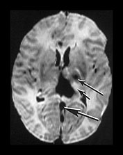 Fig. 9.14 (b)